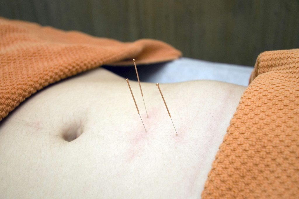 bienfait acupuncture